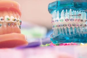 what is the orthodontics